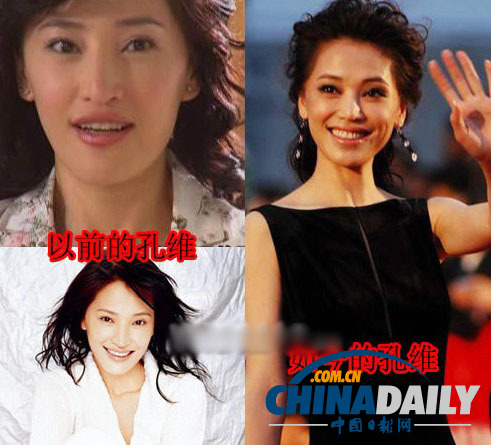 柳岩李小璐杨幂 女星整容前惊人对比照