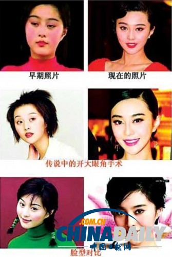 柳岩李小璐杨幂 女星整容前惊人对比照