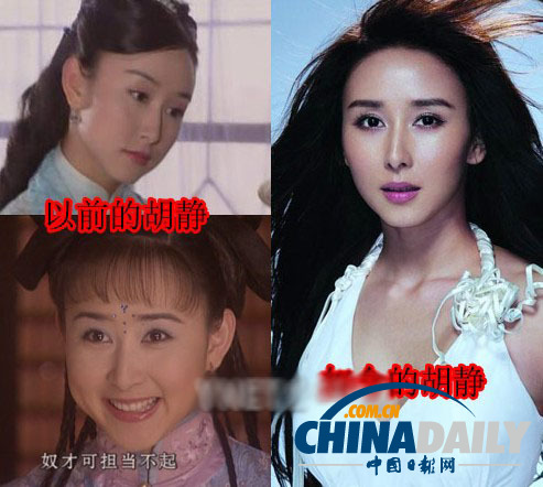 柳岩李小璐杨幂 女星整容前惊人对比照