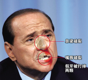 贝卢斯科尼称原谅袭击者 但要求法院予以严惩