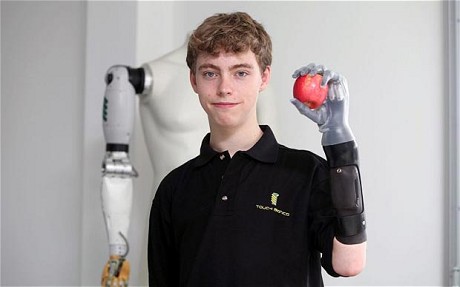 英残疾男孩信件感动F1奔驰车队 免费获装顶级仿生手