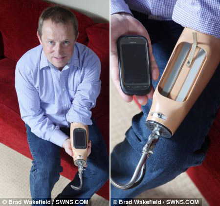 为方便接打电话 英国独臂男子将智能手机嵌入假肢