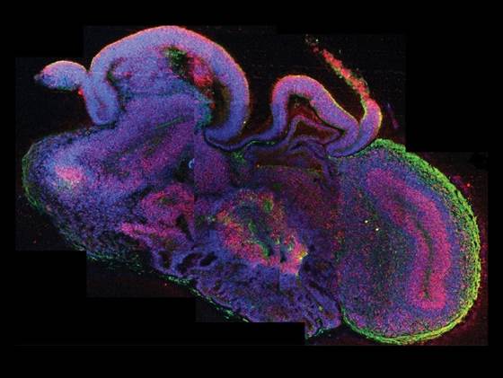 科学家利用干细胞培育人脑 达9周胎儿水平