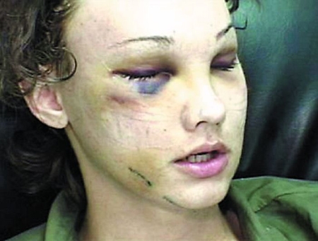 整容真人秀如看 三级片 (组图)