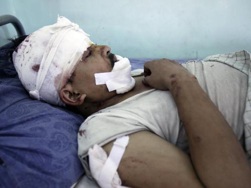 阿富汗首都发生自杀式爆炸 至少57人死伤