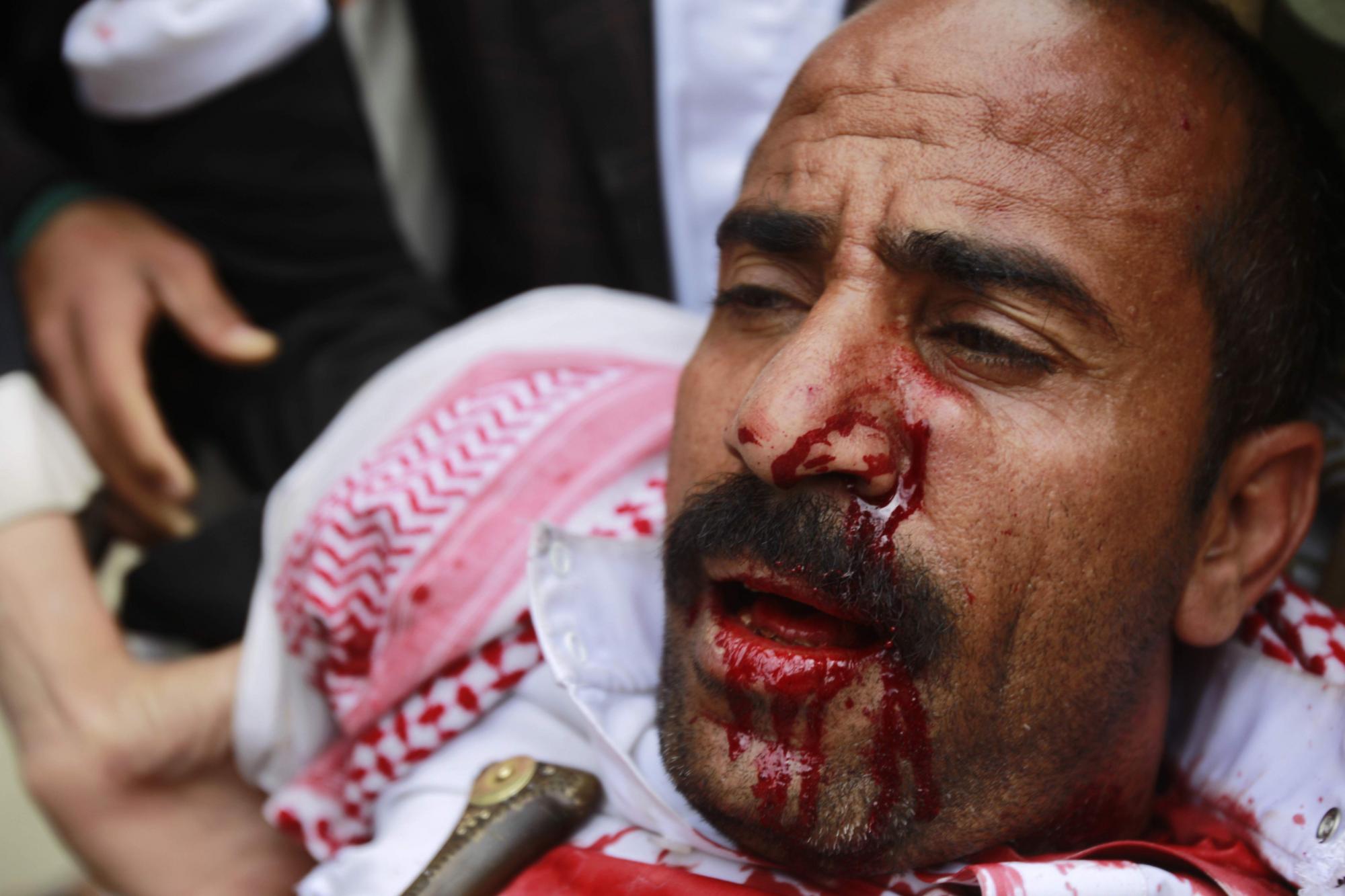 也门46名示威者遭枪杀 总统宣布全国进入紧急状态