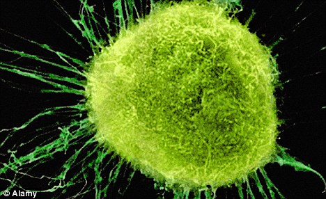 瑞士科学家发现癌细胞扩散主力蛋白质 或开启