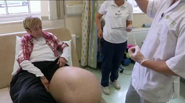 英女子患罕见疾病双腿重200斤 基因疗法有望助其再次走路