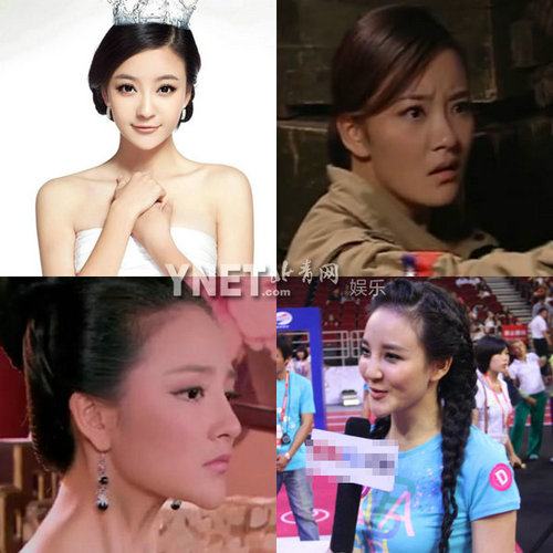 明星整容惨面瘫 大S李小璐越发诡异