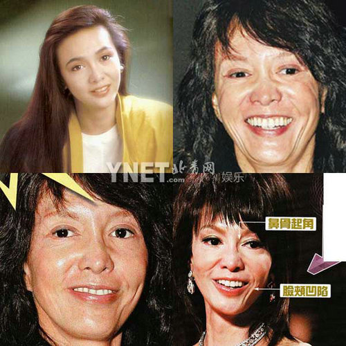 明星整容惨面瘫 大S李小璐越发诡异