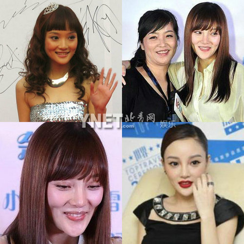明星整容惨面瘫 大S李小璐越发诡异