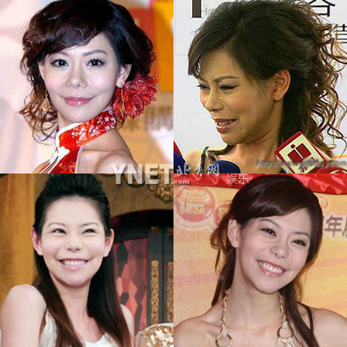 明星整容惨面瘫 大S李小璐越发诡异