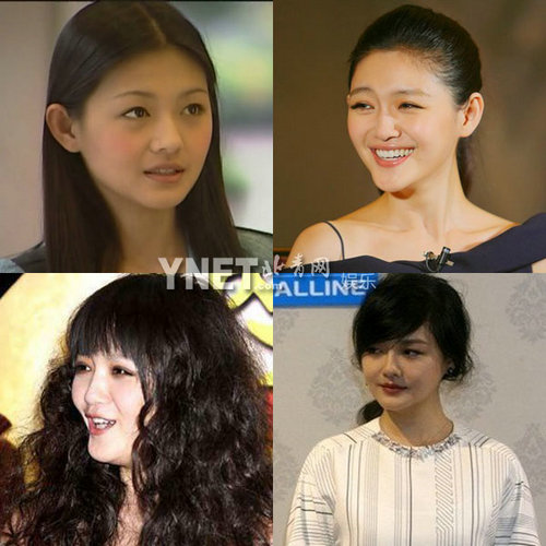 明星整容惨面瘫 大S李小璐越发诡异