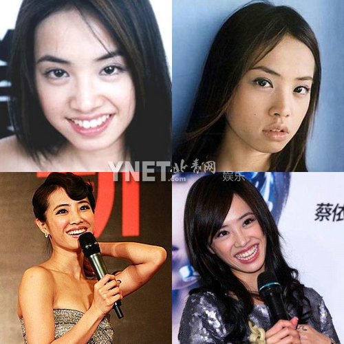 明星整容惨面瘫 大S李小璐越发诡异