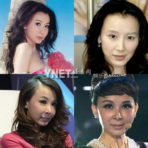 明星整容惨面瘫 大S李小璐越发诡异