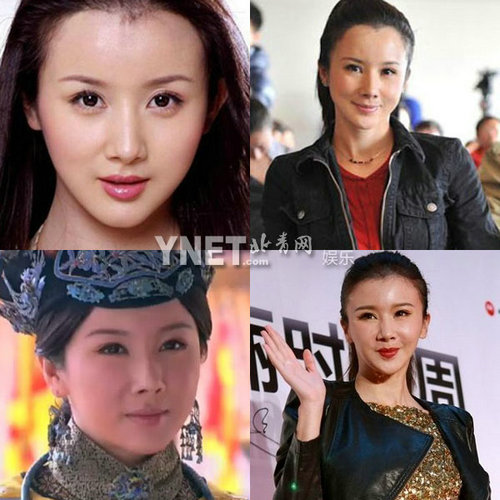 明星整容惨面瘫 大S李小璐越发诡异