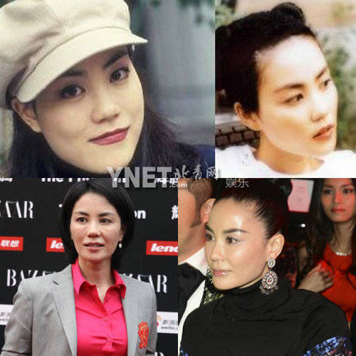 明星整容惨面瘫 大S李小璐越发诡异