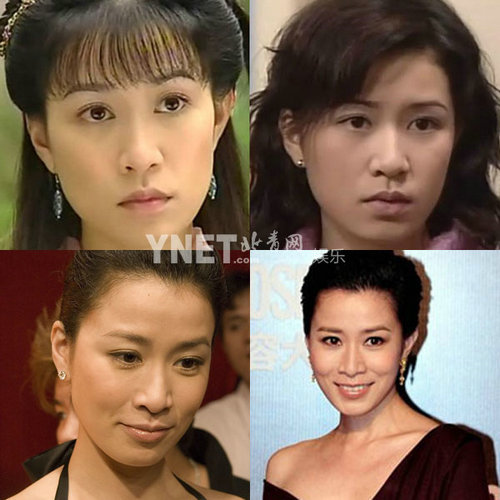 明星整容惨面瘫 大S李小璐越发诡异