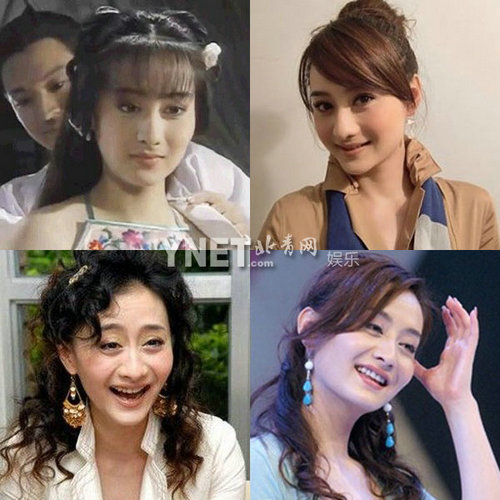 明星整容惨面瘫 大S李小璐越发诡异