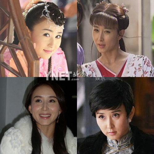 明星整容惨面瘫 大S李小璐越发诡异