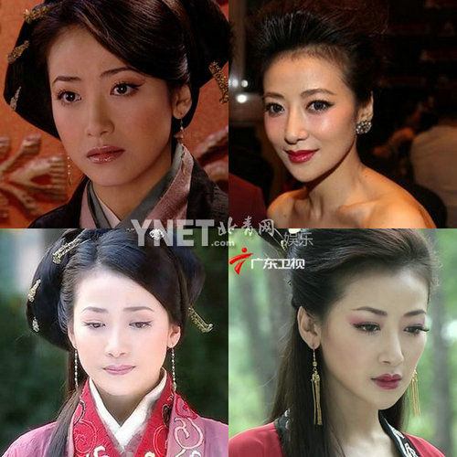 明星整容惨面瘫 大S李小璐越发诡异
