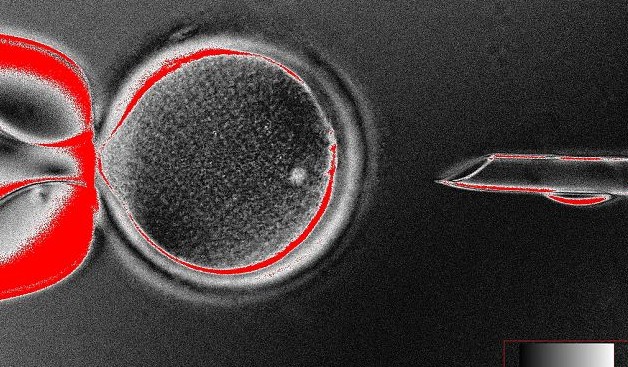 美科学家培育出人类胚胎干细胞 引发克隆人类担忧