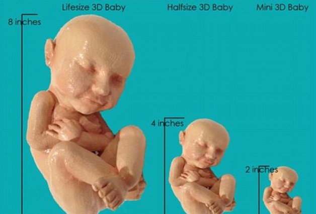 3D打印带你见未出生胎儿！体位表情皮肤性别皆可见