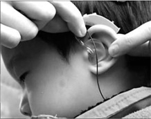 Help for the deaf