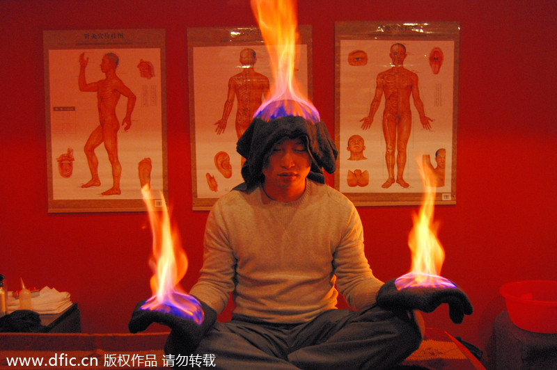 Culture insider: TCM fire treatment