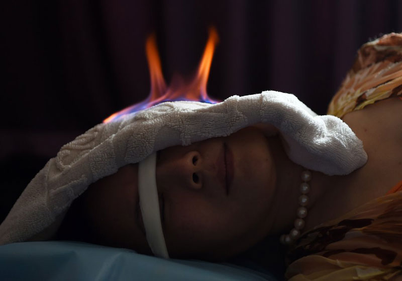 Culture insider: TCM fire treatment