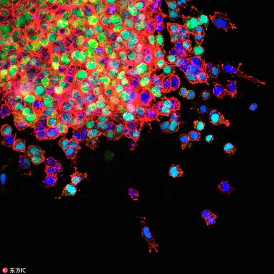 Aust'n researchers discover key to prolonging life of cancer-fighting cells
