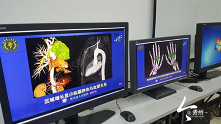 Guizhou recruits AI ‘doctor’ to diagnose medical scans