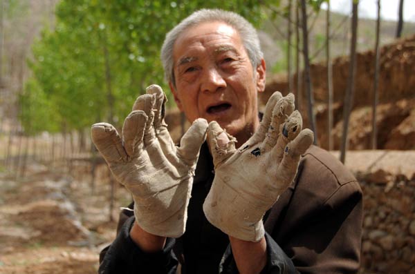 Legless veteran planted 3,000 trees in 10 years<BR>