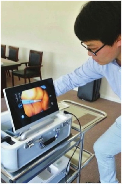 一台傻瓜机专查小儿眼病