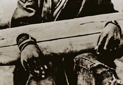 A serf's fingers were cut off