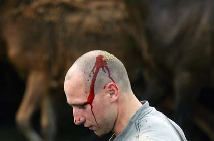 A man bleeds on the head after being struck by a horse during the "Rapa Das Bestas" event in Sabucedo July 1, 2006. On the first weekend of the month of July, hundreds of wild horses are rounded up, trimmed and groomed in different villages in Spain's northwestern region of Galicia. 