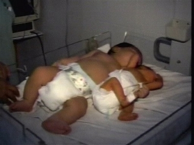 In this image from television, nurses hold the baby known as 'Super Tonio,' in Jesus Kumate Rodriguez hospital in Cancun Mexico Wednesday Jan. 31, 2007. At a whopping birth weight of 6.6 kilograms (14.5 pounds), the 'little' fellow is causing a sensation in this Mexican resort city. According to doctors the baby drinks 5 ounces of milk every three hours, and measures 55 centimeters (22 inches) in length. Antonio's mother, Teresa Alejandra Cruz, 23, and father, Luis Vasconcelos, 38, said they were proud of the boy, and noted that Cruz had given birth to a baby girl seven years ago who weighed 5.2 kilograms (11.46 pounds). (AP