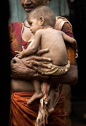 A tribal woman holds her granddaughter Rohini inside a hut in Mumbai July 25, 2007. The seven-month-old twins Rohini and her brother Rohit from a tribal family have been declared malnourished by a team of the city's civic administration doctors, local media reported. India, home to millions of underfed children despite its flourishing economy, will have eradicated malnutrition by 2015, the country's health minister said. A government survey released this year however found that 46 percent of children under the age of three years were undernourished.