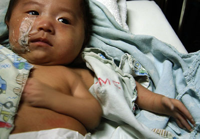 Three-armed baby receives treatment in Shanghai