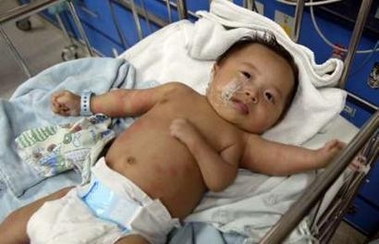 Three-armed baby receives treatment in Shanghai