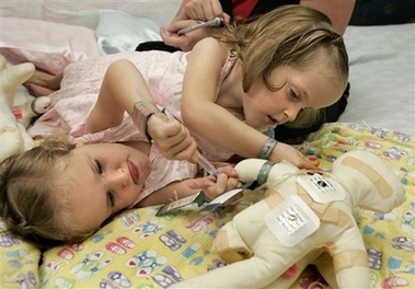 Four-year-old conjoined twins to undergo separation