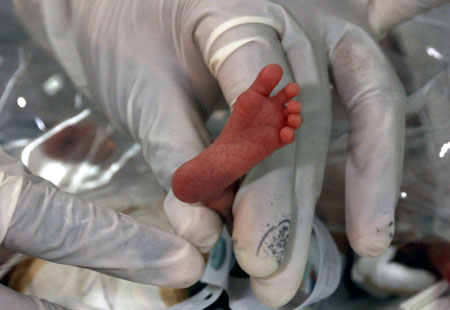 Premature baby girl
