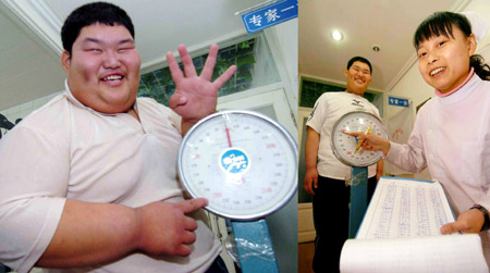 Overweight boy loses 109 kg