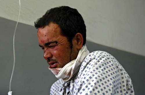 Taliban suicide bomb hits NATO convoy, kills 18