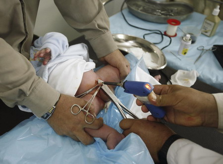 Undergoing circumcision to purify body from dirtiness