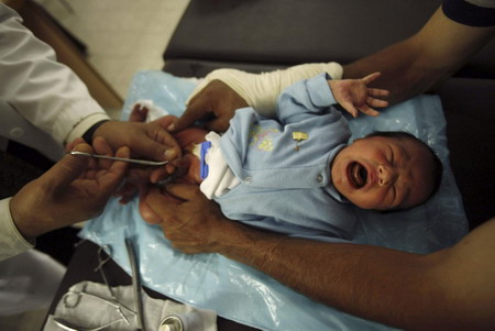 Undergoing circumcision to purify body from dirtiness