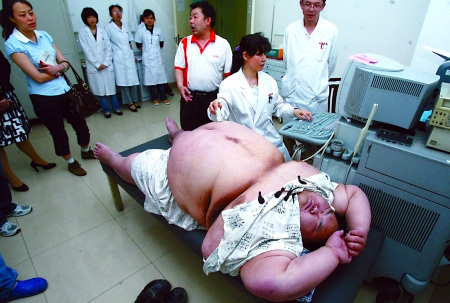 China's fattest man hospitalized in SW China