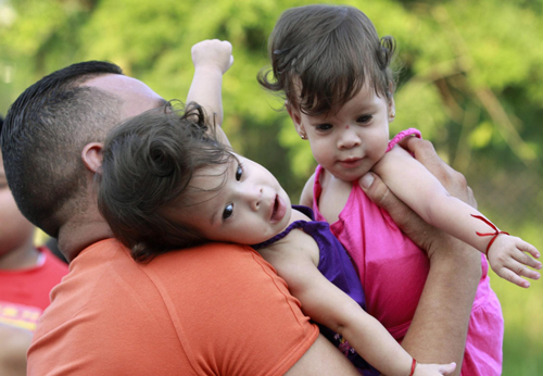Conjoined twins celebrate 1st birthday