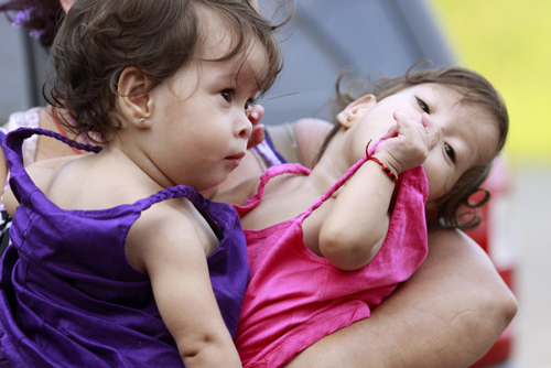 Conjoined twins celebrate 1st birthday