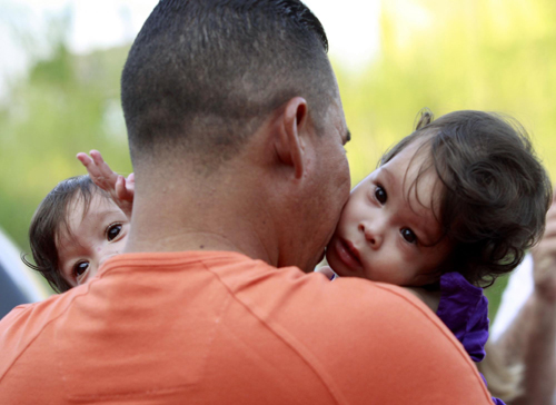 Conjoined twins celebrate 1st birthday